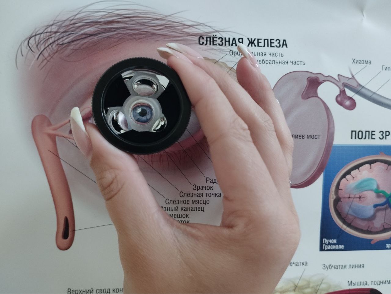 Осмотр линзой Гольдмана